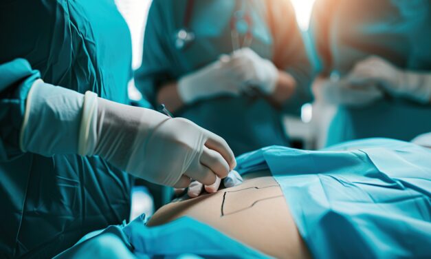 Maintaining Your Mini Tummy Tuck Results: Dos and Don’ts