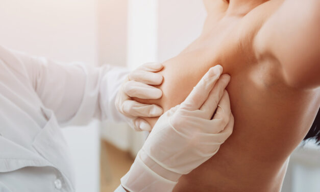 Post-Surgery Care After a Breast Lift: Essential Tips for Long-Lasting Results