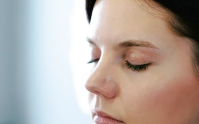 What Is Blepharoplasty?