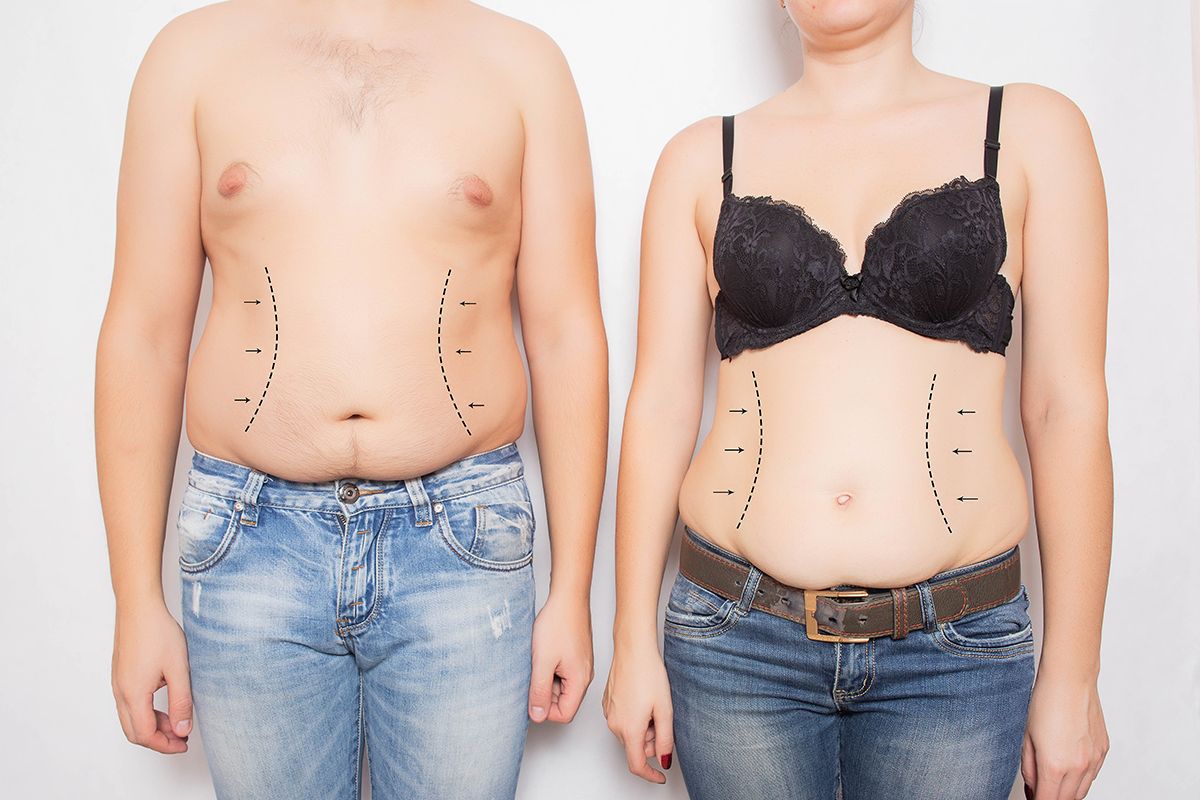 man and woman overweight and obese on his stomach man and woman overweight and obese on his stomach