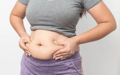 Are You a Good Candidate for a Tummy Tuck?