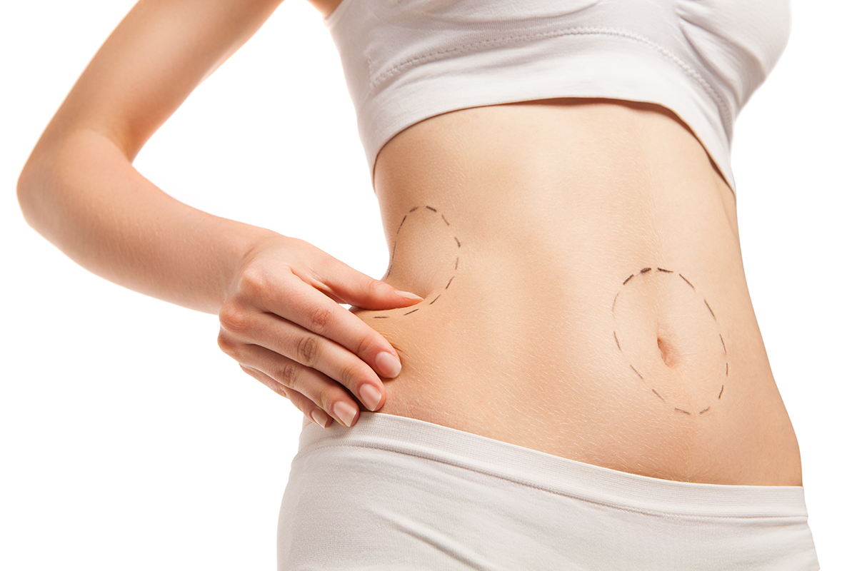 patient with outlines on body in close up patient with outlines on body in close up