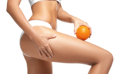 The Truth About Liposuction and Cellulite – Part 2