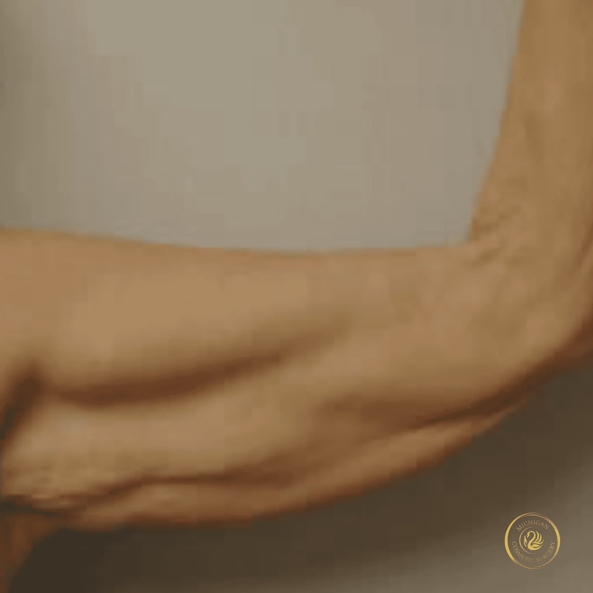 arm lift before photo by michigan cosmetic surgery in southfield mi