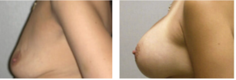 Screenshot at .. PM