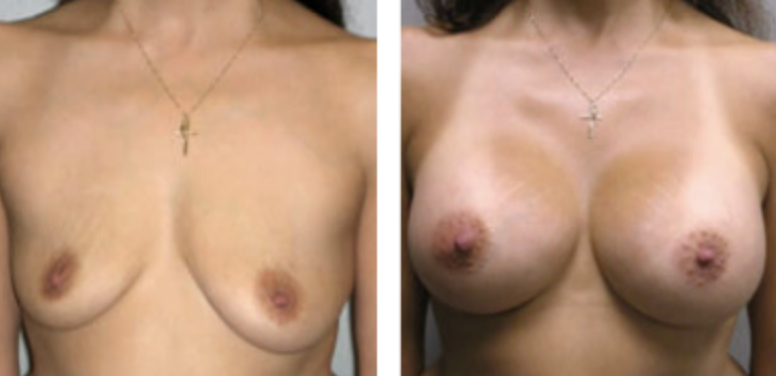 Screenshot at .. PM