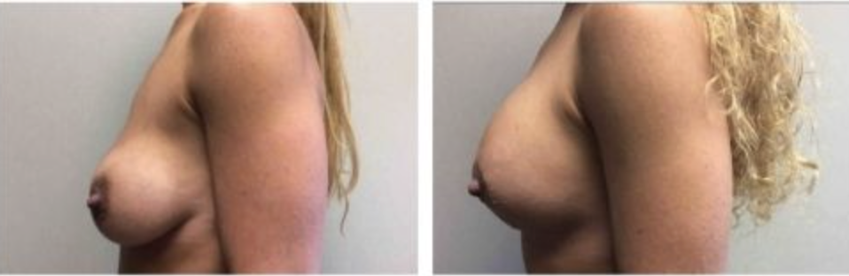 Screenshot at .. PM