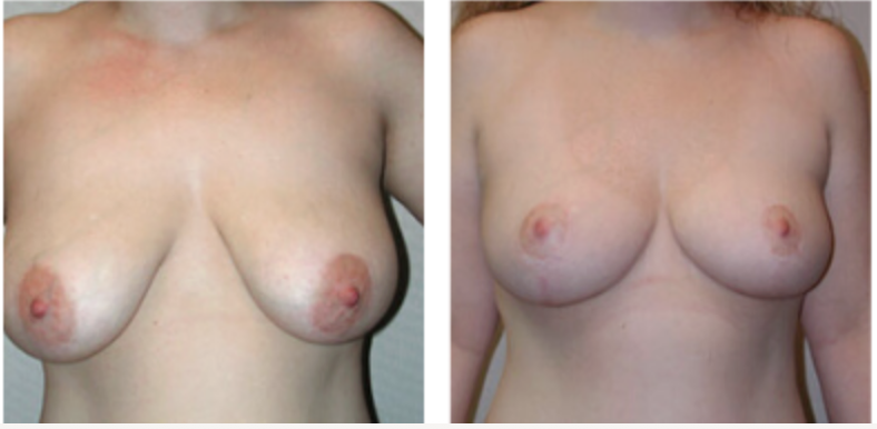 Screenshot at .. PM