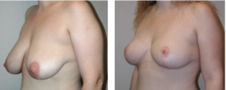 Screenshot at .. PM