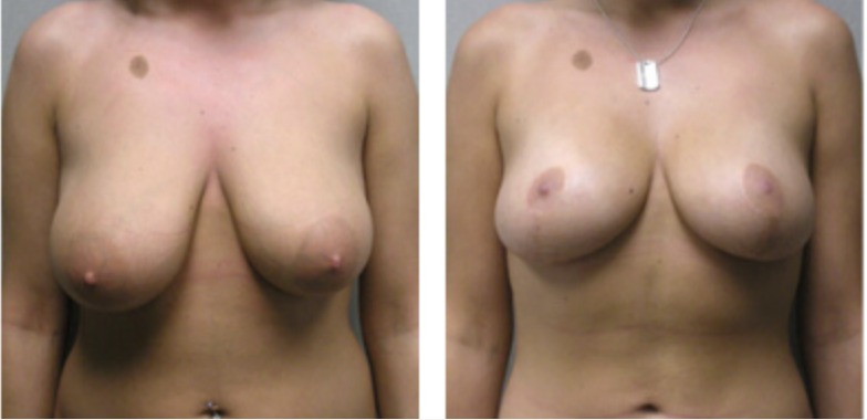 Screenshot at .. PM