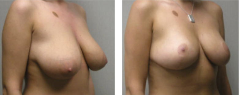 Screenshot at .. PM