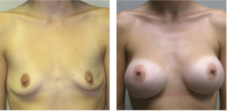 Screenshot at .. PM