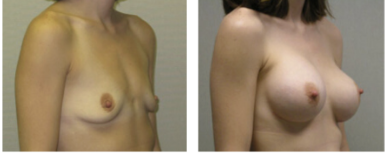 Screenshot at .. PM