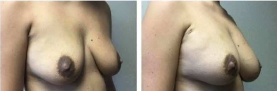 Screenshot at .. PM