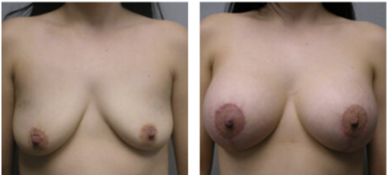 Screenshot at .. PM