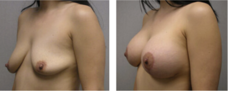 Screenshot at .. PM