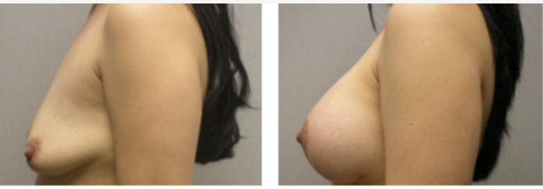 Screenshot at .. PM