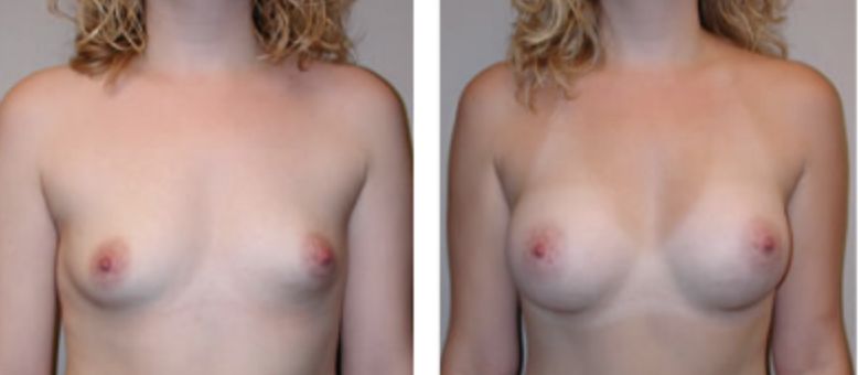 Screenshot at .. PM