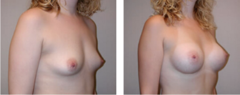 Screenshot at .. PM