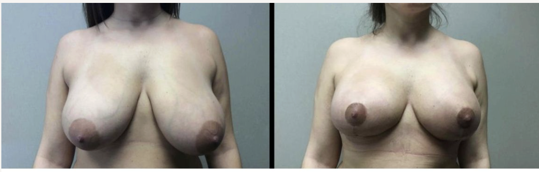 Screenshot at .. PM