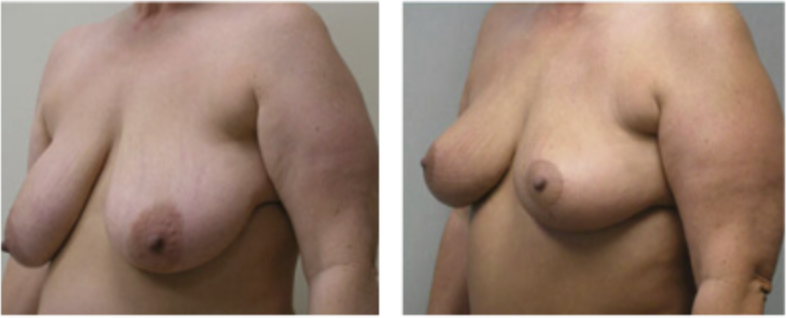 Screenshot at .. PM