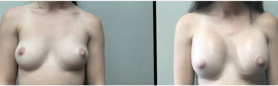 Screenshot at .. PM