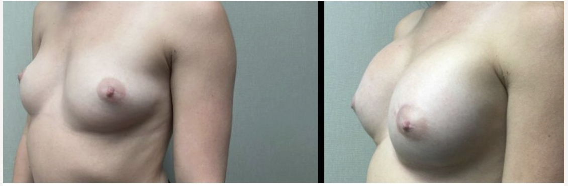 Screenshot at .. PM