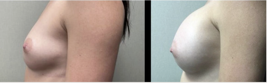 Screenshot at .. PM