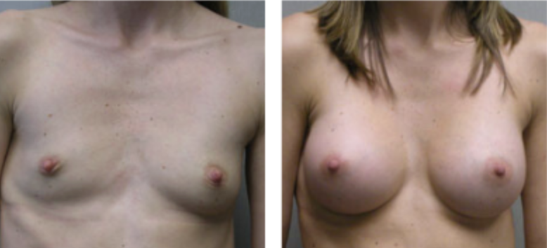 Screenshot at .. PM