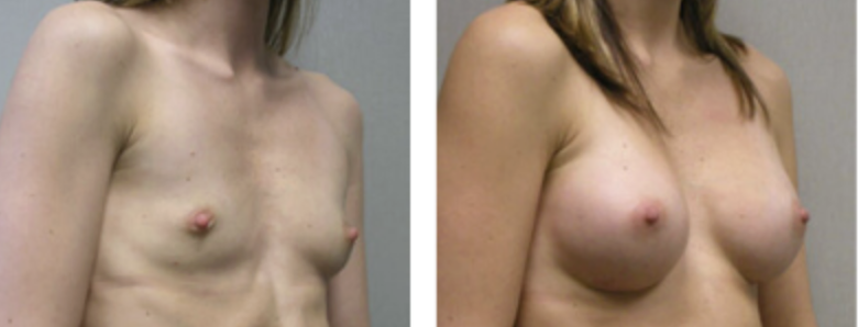 Screenshot at .. PM