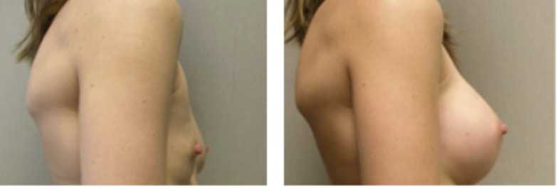 Screenshot at .. PM