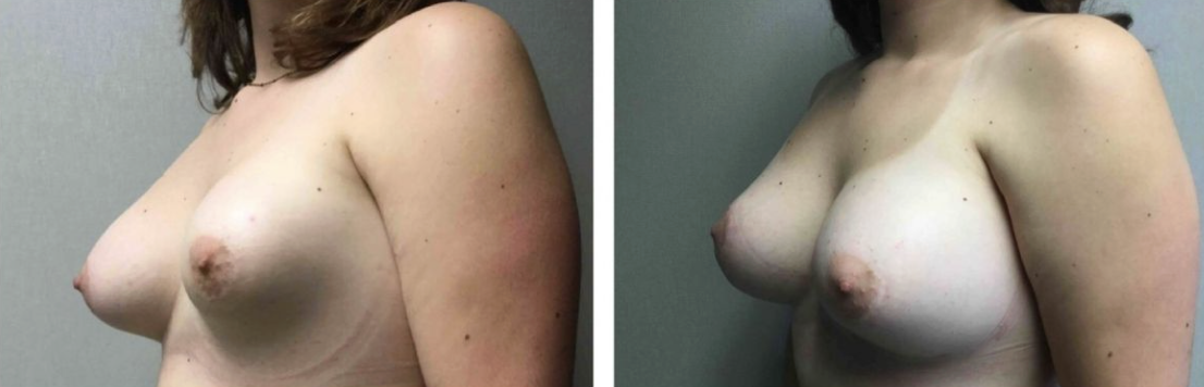 Screenshot at .. PM