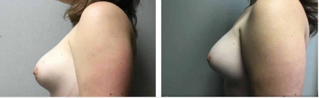 Screenshot at .. PM