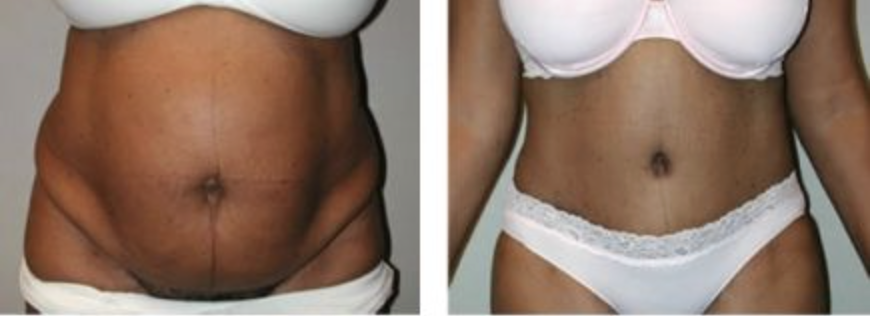 Screenshot at .. PM