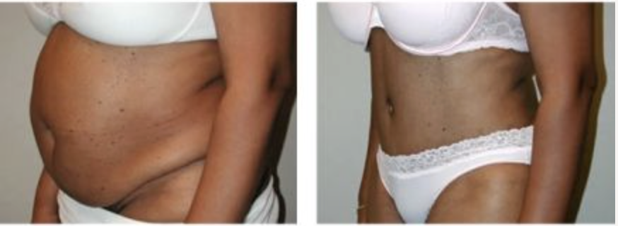 Screenshot at .. PM