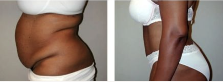 Screenshot at .. PM