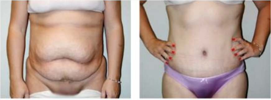 Screenshot at .. PM