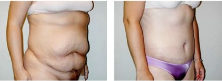 Screenshot at .. PM