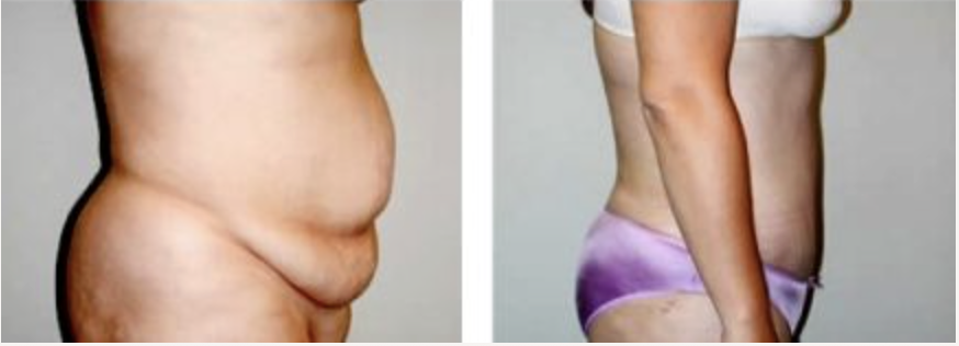 Screenshot at .. PM