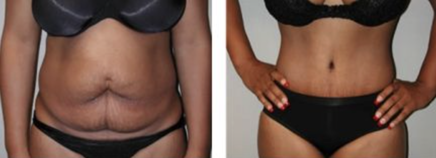 Screenshot at .. PM