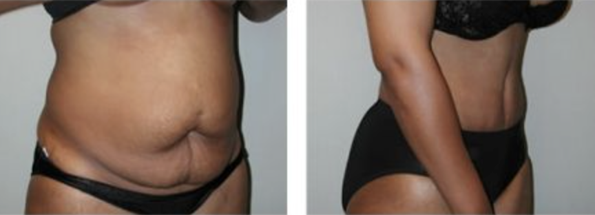 Screenshot at .. PM