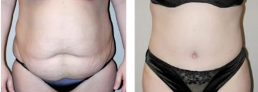 Screenshot at .. PM