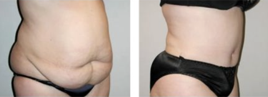 Screenshot at .. PM