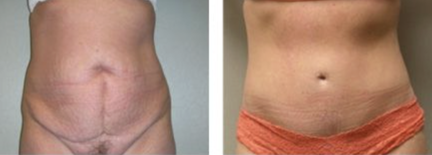 Screenshot at .. PM