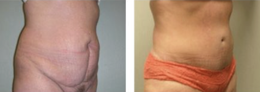 Screenshot at .. PM