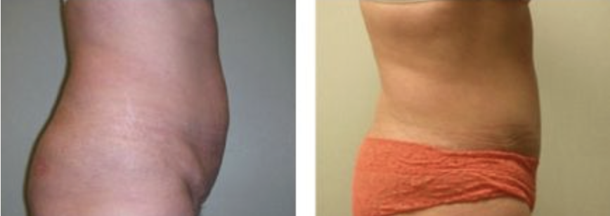 Screenshot at .. PM