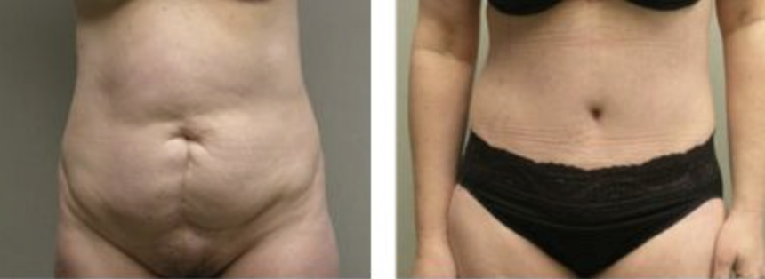 Screenshot at .. PM