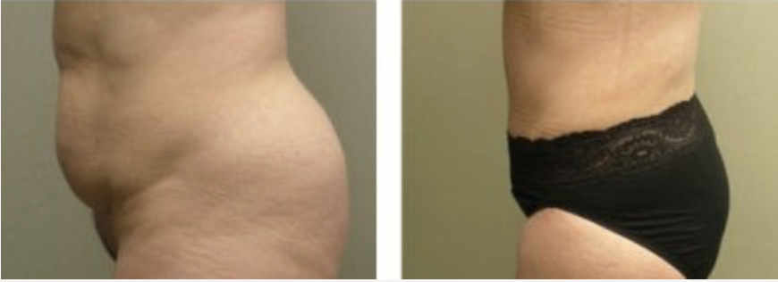 Screenshot at .. PM