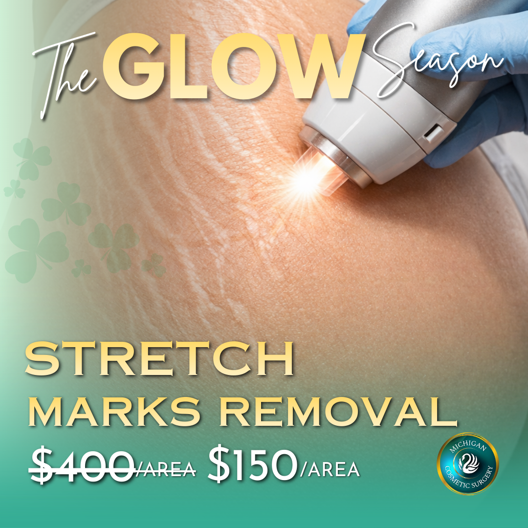 Stretch Marks Removal in Michigan Stretch Marks Removal in Michigan
