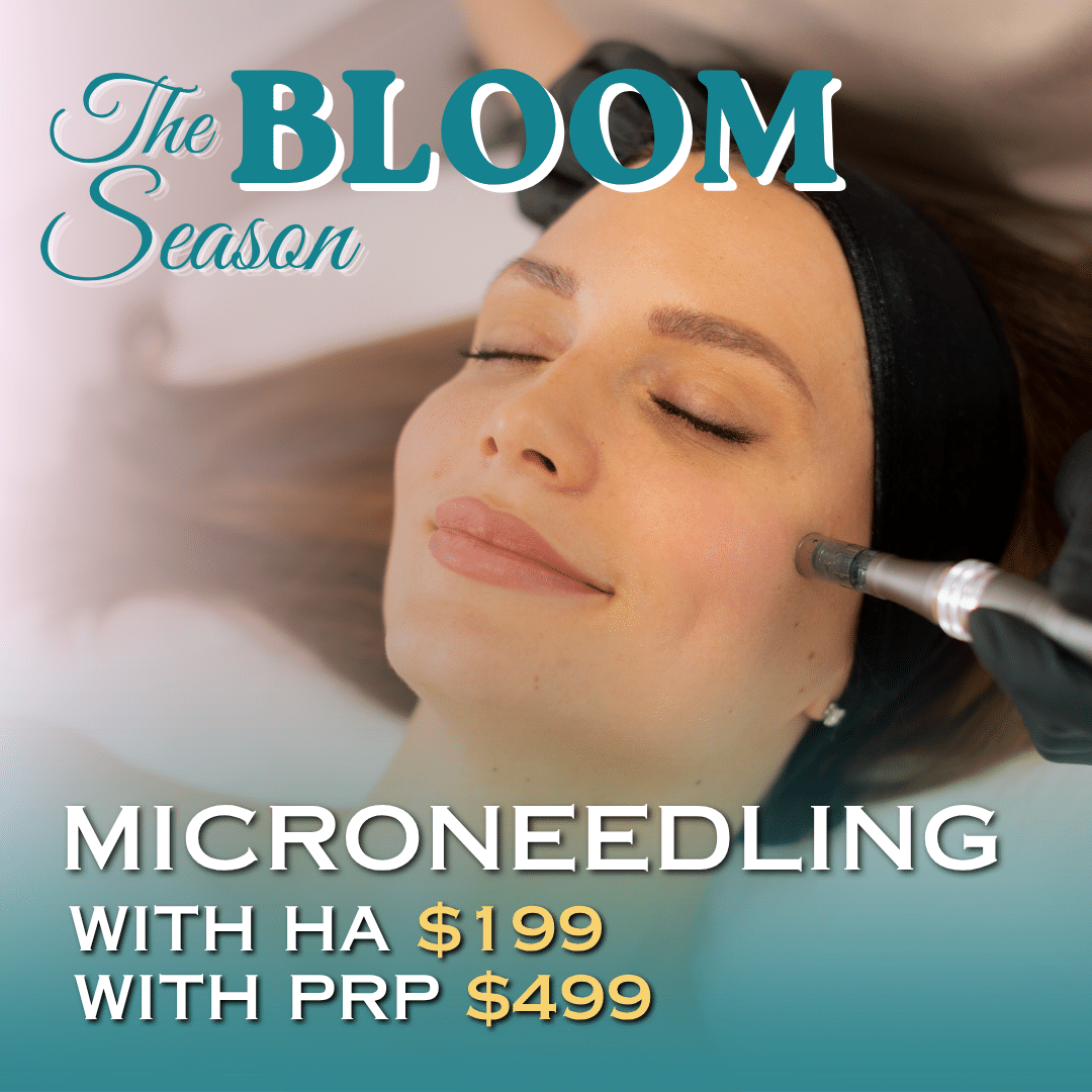 Microneedling in Detroit Michigan Microneedling in Detroit Michigan